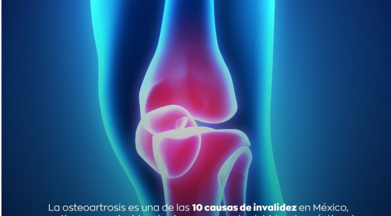 Innovador Suplemento Alimenticio Para Mejorar la Salud Osteoarticular en la Población Mexicana